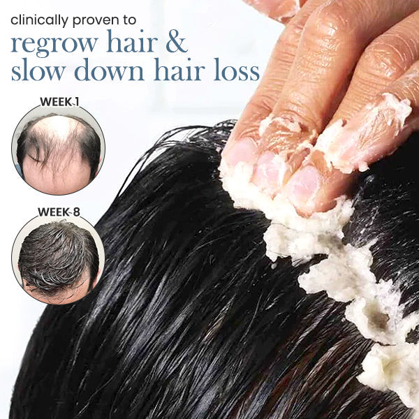 Liascy™ RootRestore Hair Scrub