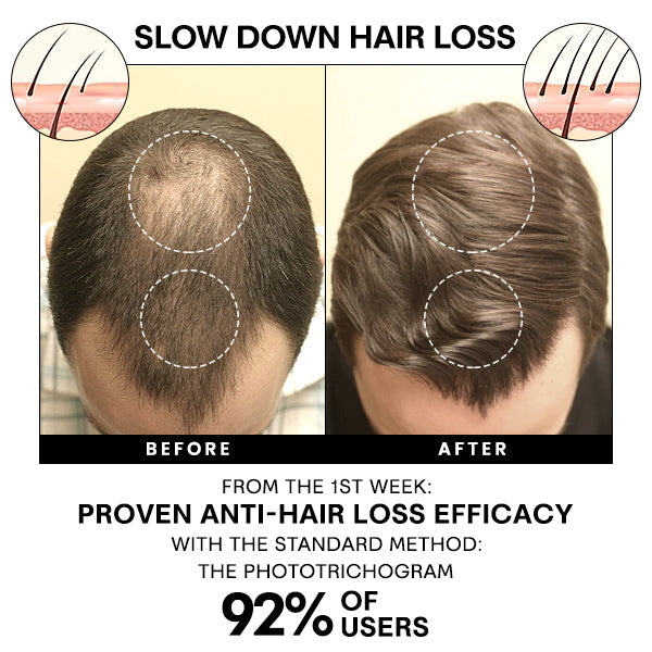 Liascy™ Anti-Shedding Hair Spray
